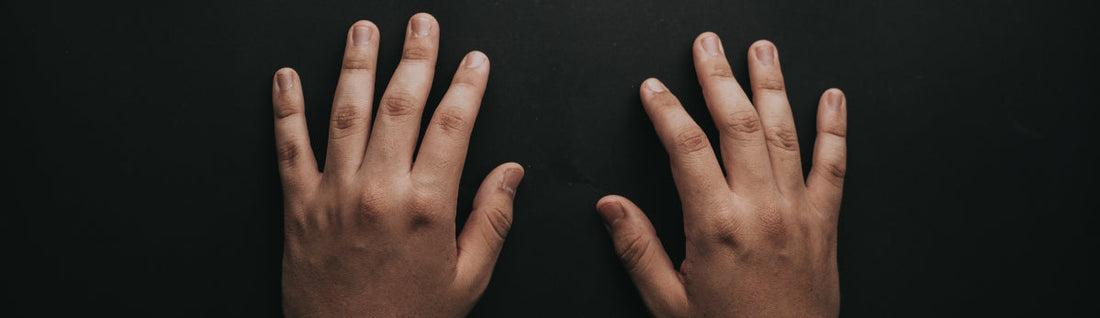 Worried about side effects of arthritis medications? Your DNA is the key to long-term safety of treatment