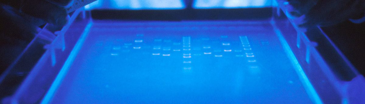agarose gel with DNA bands